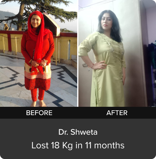 Dr Shweta's transformation